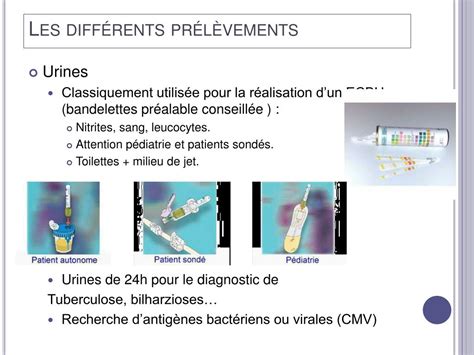 ggvsj prélèvement|gc re protected prélèvement c'est quoi.